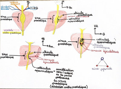 Dessins prostate.jpg