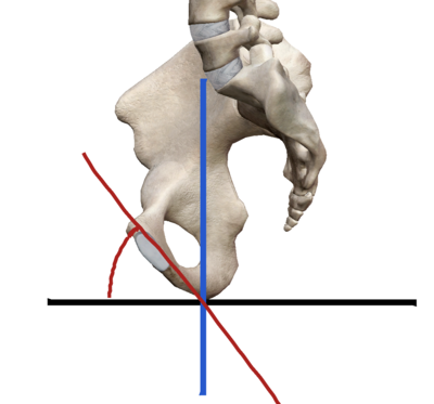 Vue sagittale du bassin.png