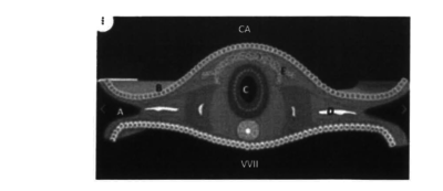 coupe transversale d'un embryon .png