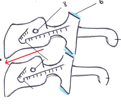 espace intervertébral.png