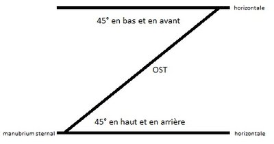 OST ultra-patatoïde.jpg