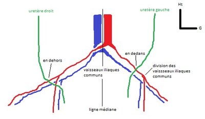 Uretère patatoïde.jpg